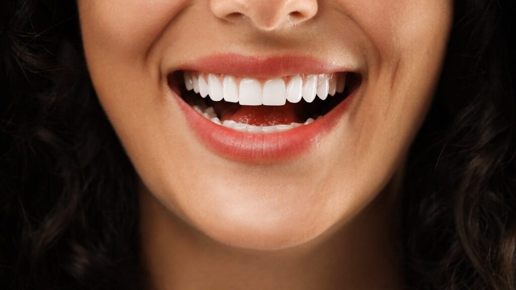Teeth Whitening Process: 5 Easy Steps 1 Teeth Whitening