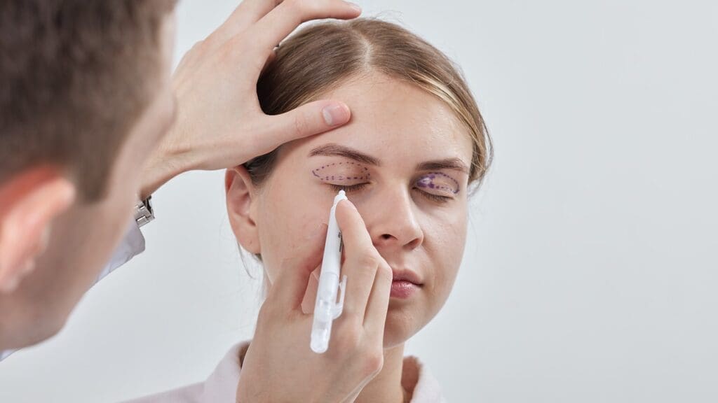 Blepharoplasty: 5 Facts You Should Know 1 Blepharoplasty