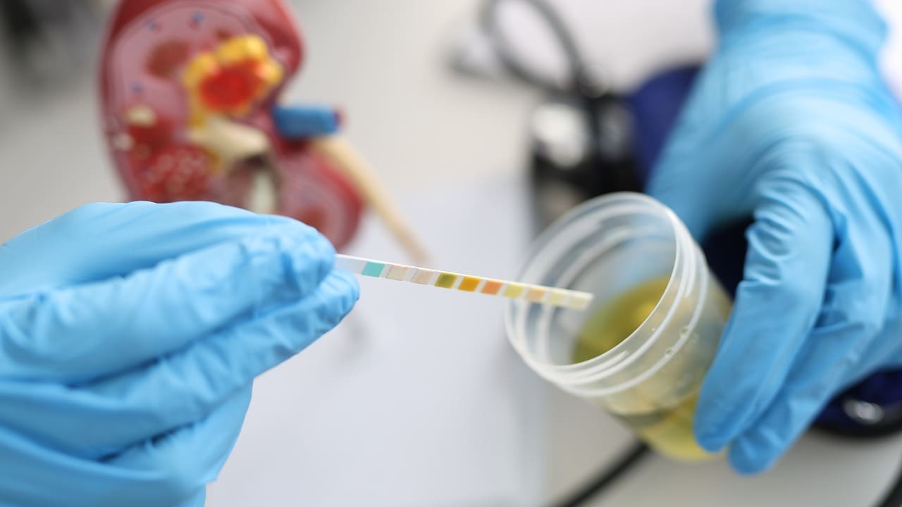 Pediatric Nephrology 6 Pediatric Nephrology