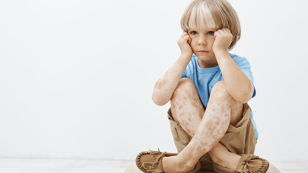 Pediatric dermatology