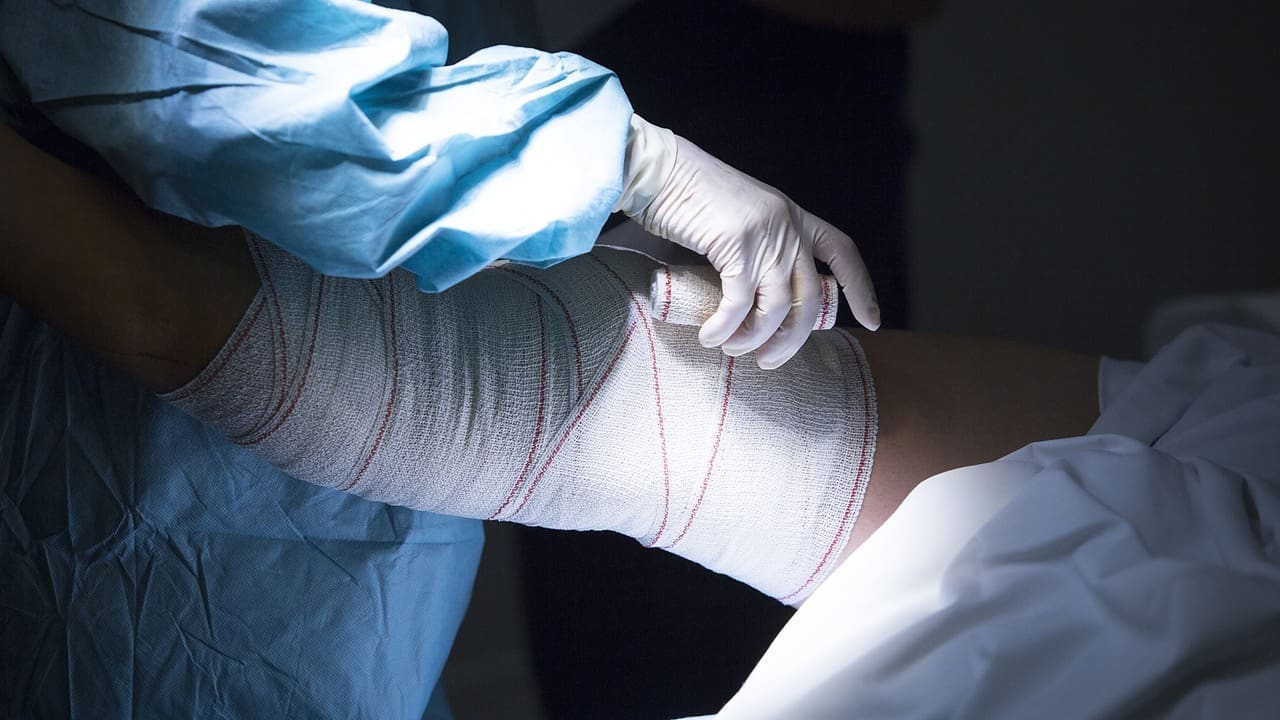 midsection doctor applying bandage patient leg hospital yt thumbnail 1280 720 LIV Hospital