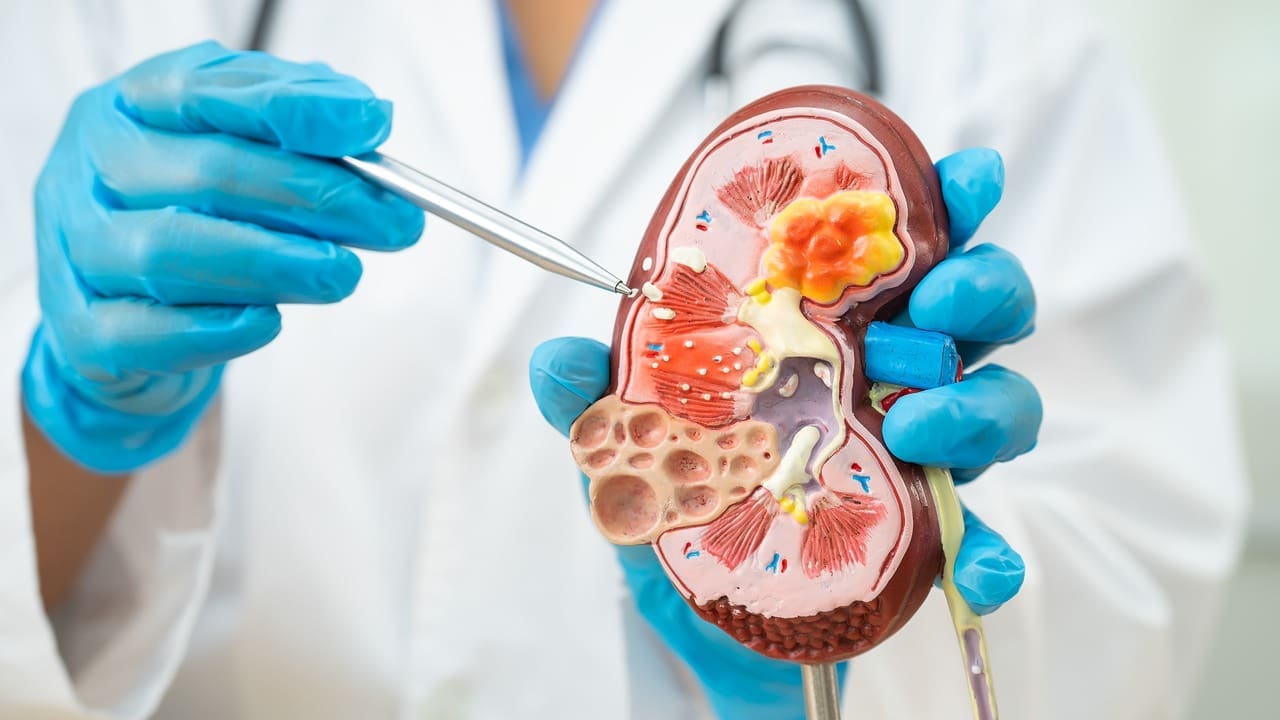 Nephrology Clinic 1 Nephrology Clinic