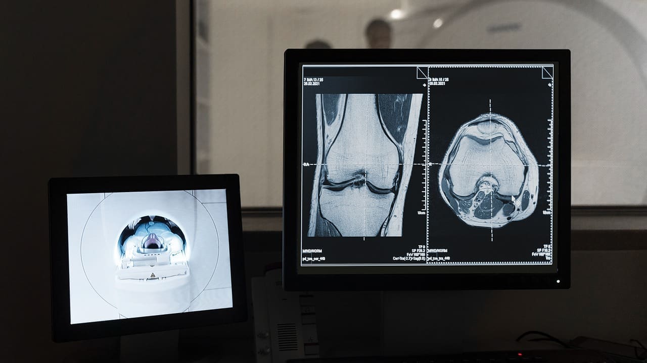Interventional Radiology 4 Interventional Radiology