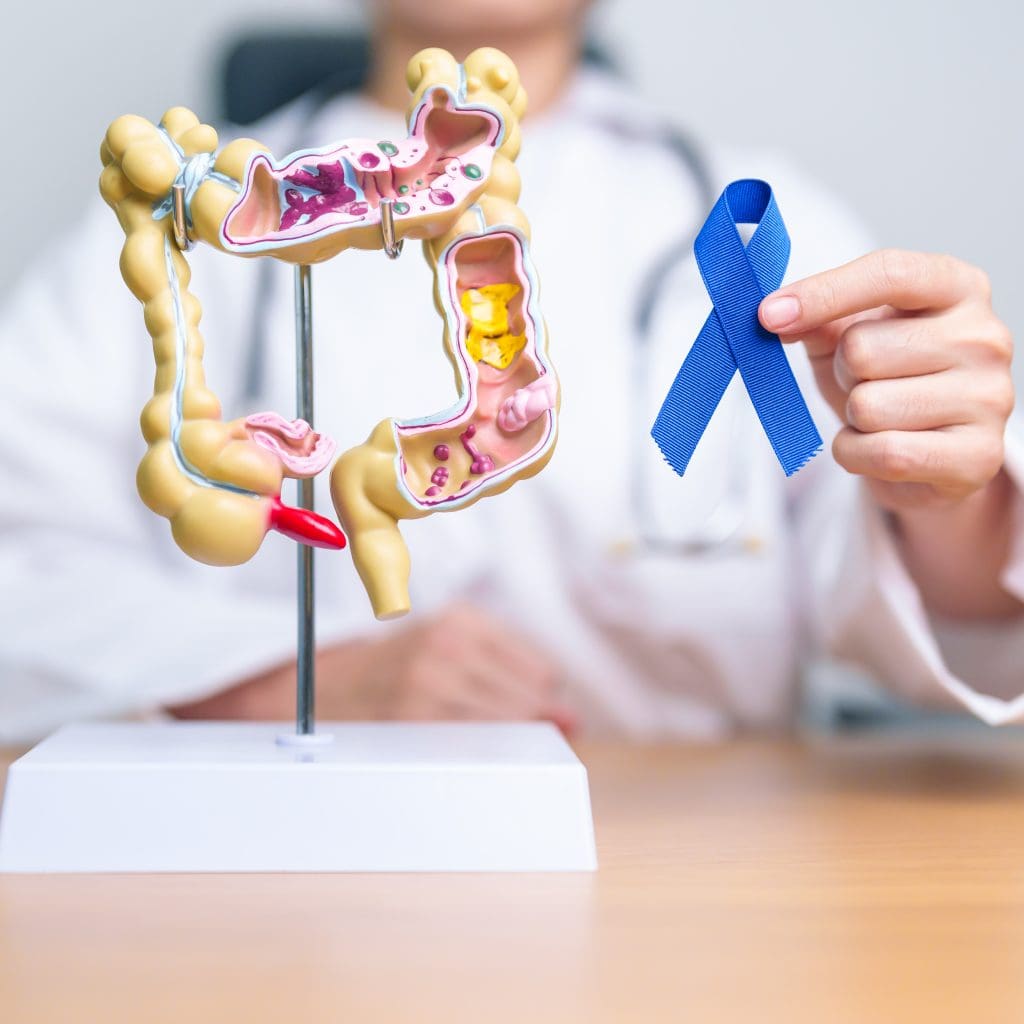 Does Colon Cancer Hurt? 1 Does Colon Cancer Hurt? Â