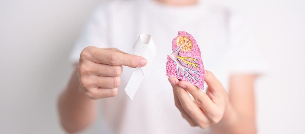 Can you be cured of lung cancer?