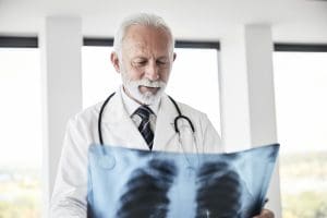 Which Lung Cancer Spreads the Fastest?