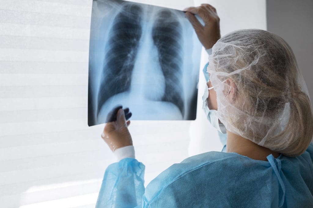 lung cancer spreads the fastest