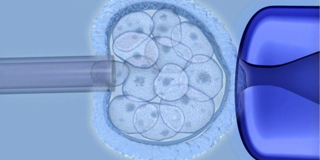 Embryonic stem cells LIV Hospital