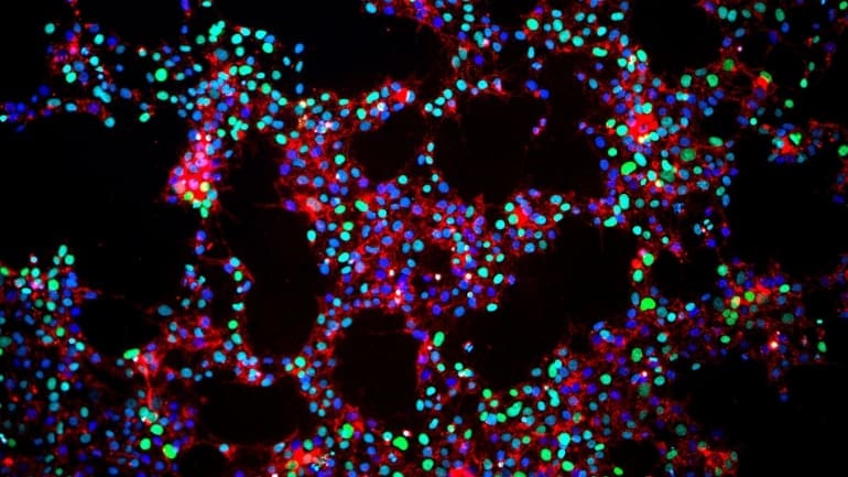 ips cells LIV Hospital