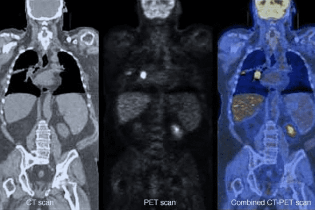 PET Scan Not Recommended: When Doctors Avoid Using This Imaging Test 3 PET Scan Not Recommended: When Doctors Avoid Using This Imaging Test