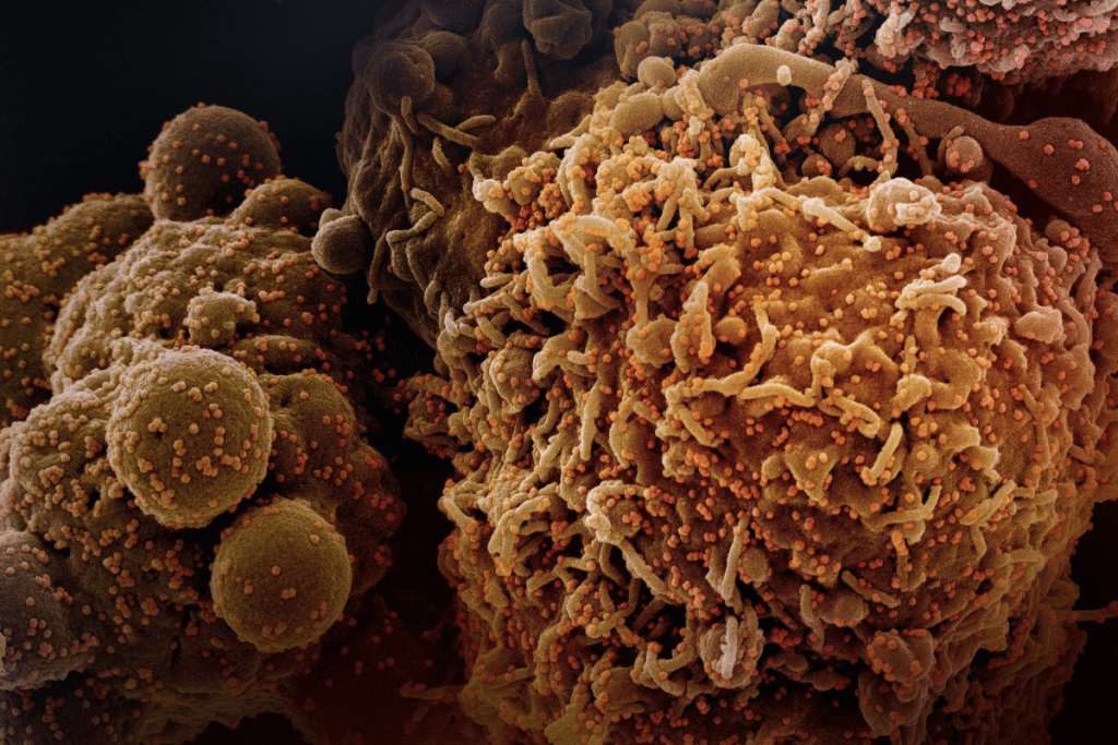 Is immunotherapy better than targeted therapy?