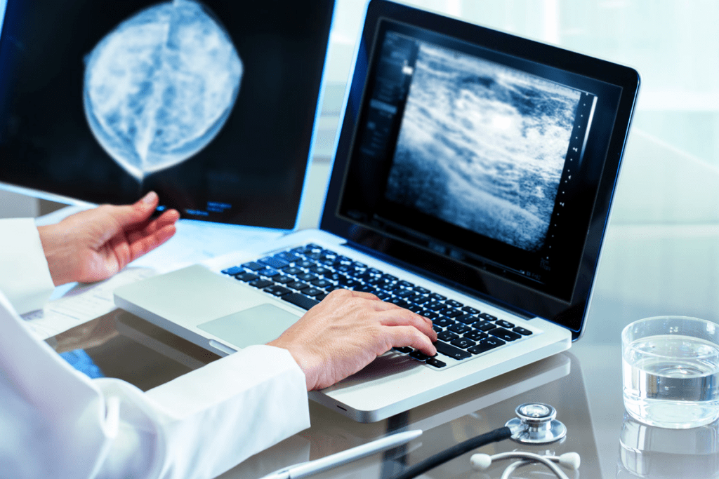 PET Scan Lungs: Detecting Lung Disease, Cancer, and Infections Early 3 PET Scan Lungs: Detecting Lung Disease, Cancer, and Infections Early