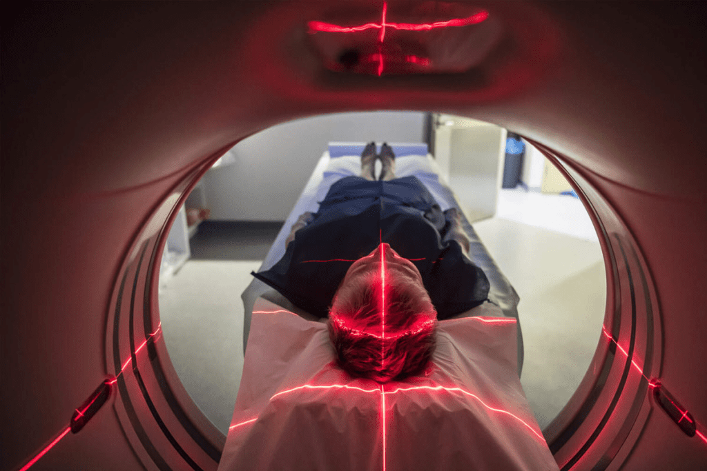 Can a CT Scan Show Colon Cancer? 1 Can a CT scan show colon cancer