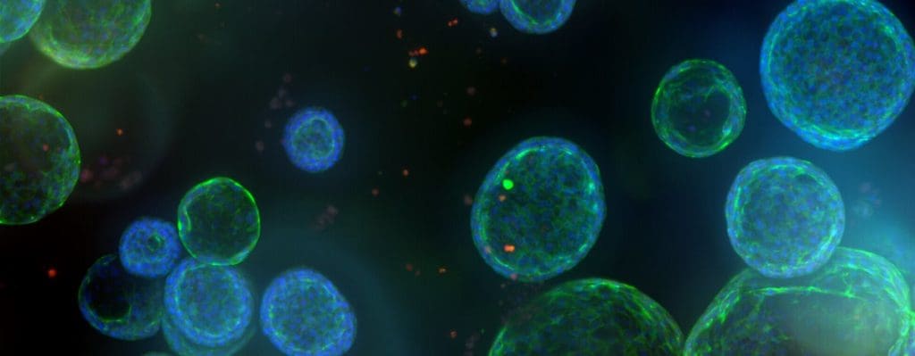 media 1302b354856c6261eda3552e4706096f5a306330b LIV Hospital