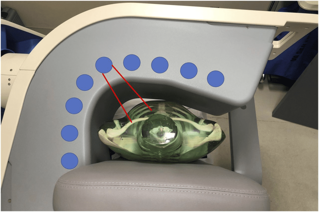 Inflammation Imaging Eating Before SPECT: Powerful Detection of Hidden Inflammation 2 eating before SPECT