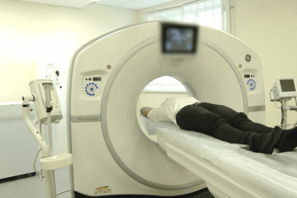 PET Scan Miss Metastasis: Why Some Cancer Spread Can Be Overlooked