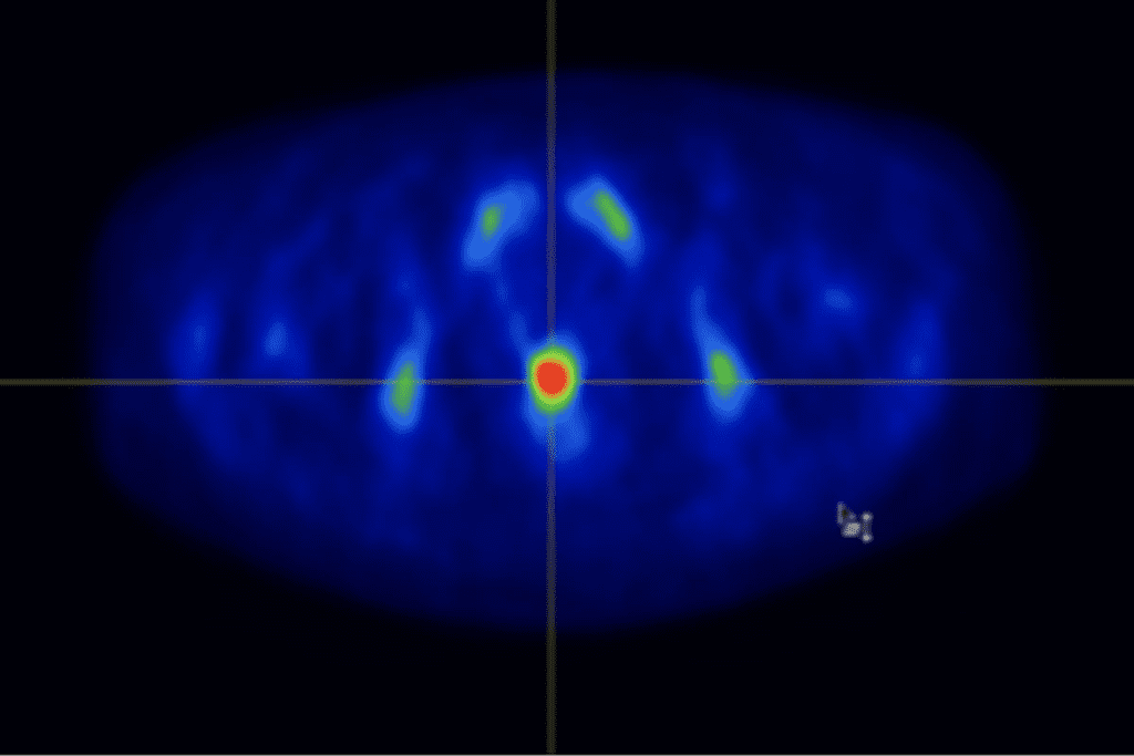 What Problems Can a PET Scan Detect? Powerful Overview