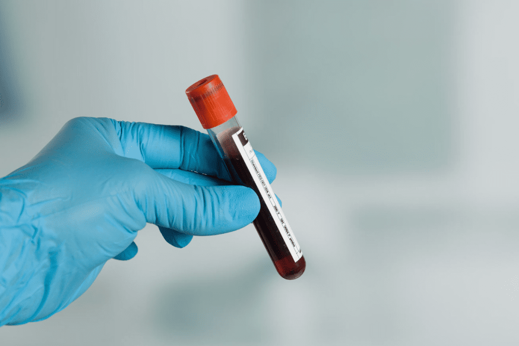 CT Scan Wrong Lung Cancer Diagnosis: Causes and How to Confirm Results