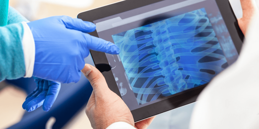 Arthritis Confirming Scan: Powerful Detection for Early Diagnosis