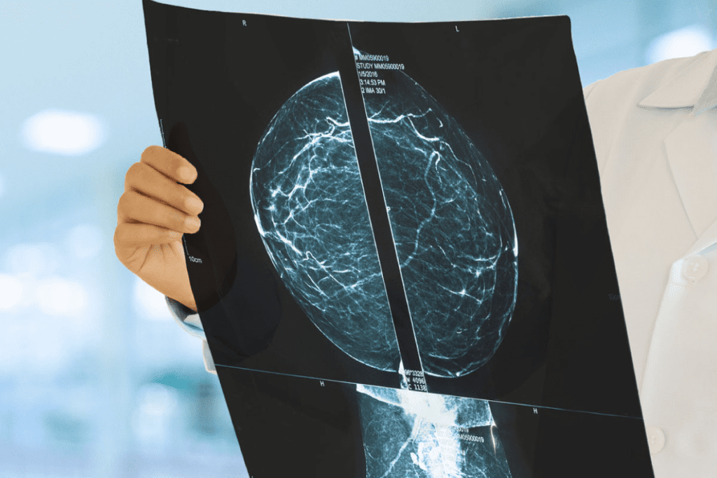 First Signs Metastatic Cancer: Early Symptoms to Watch For and Act On 2 First Signs Metastatic Cancer: Early Symptoms to Watch For and Act On