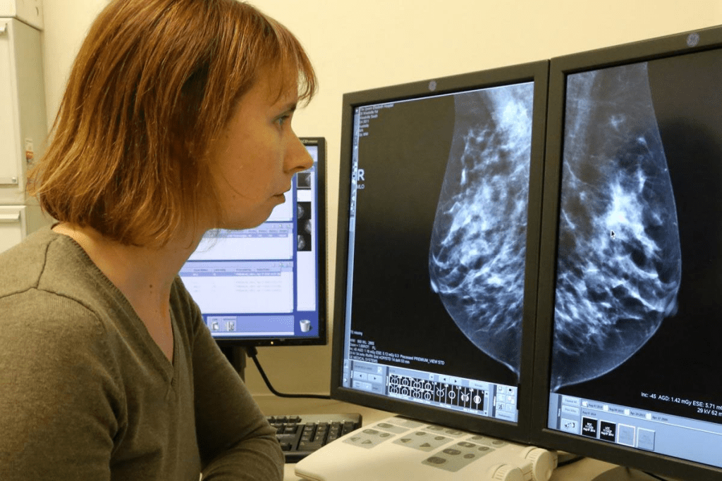 Most Accurate Scan for Cancer: PET, CT, MRI, and Other Imaging Types