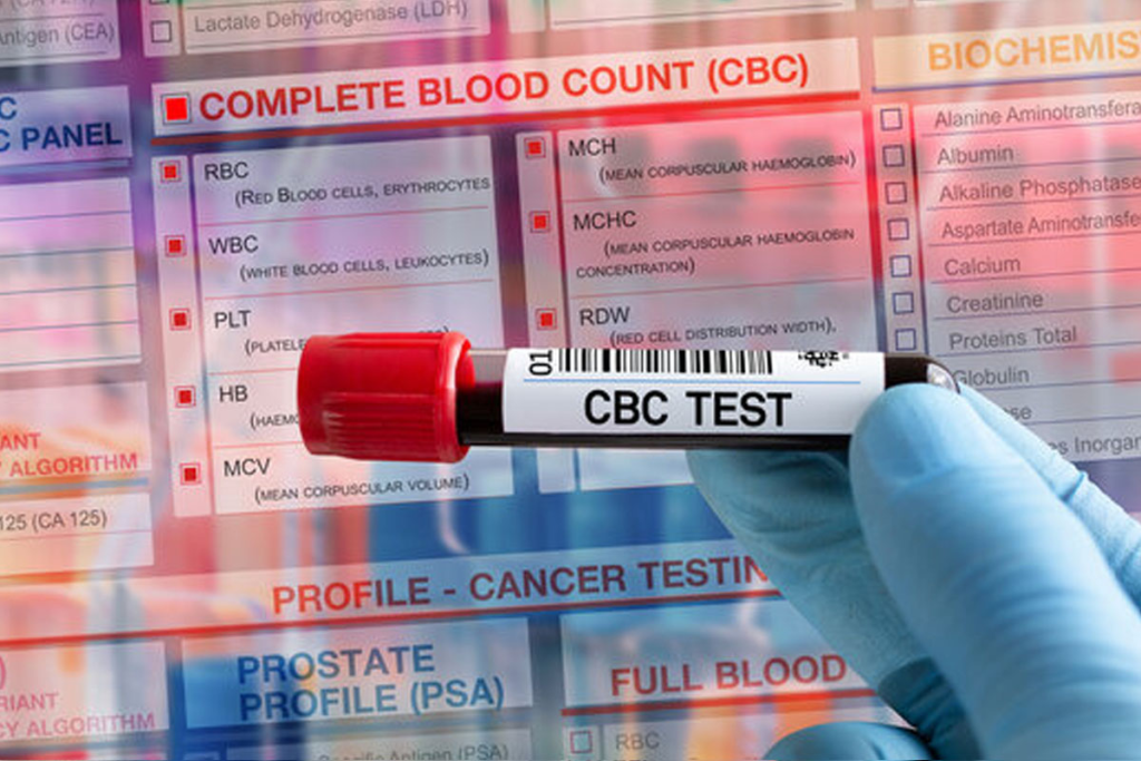 Blood Tests That May Indicate Cancer: Powerful Warning Signs