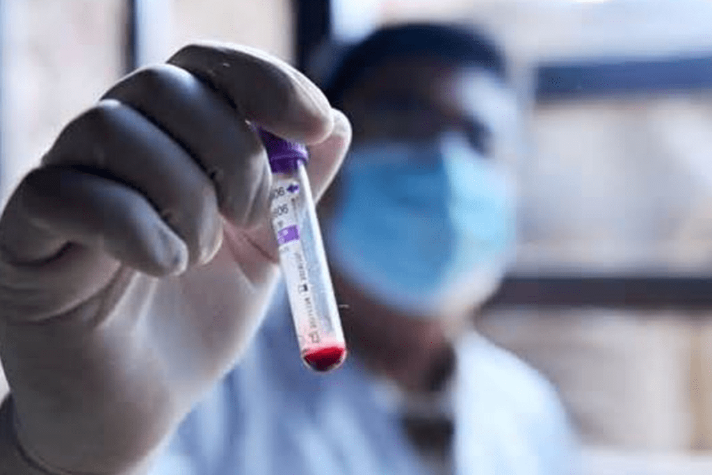 Blood Tests That May Indicate Cancer: Powerful Warning Signs
