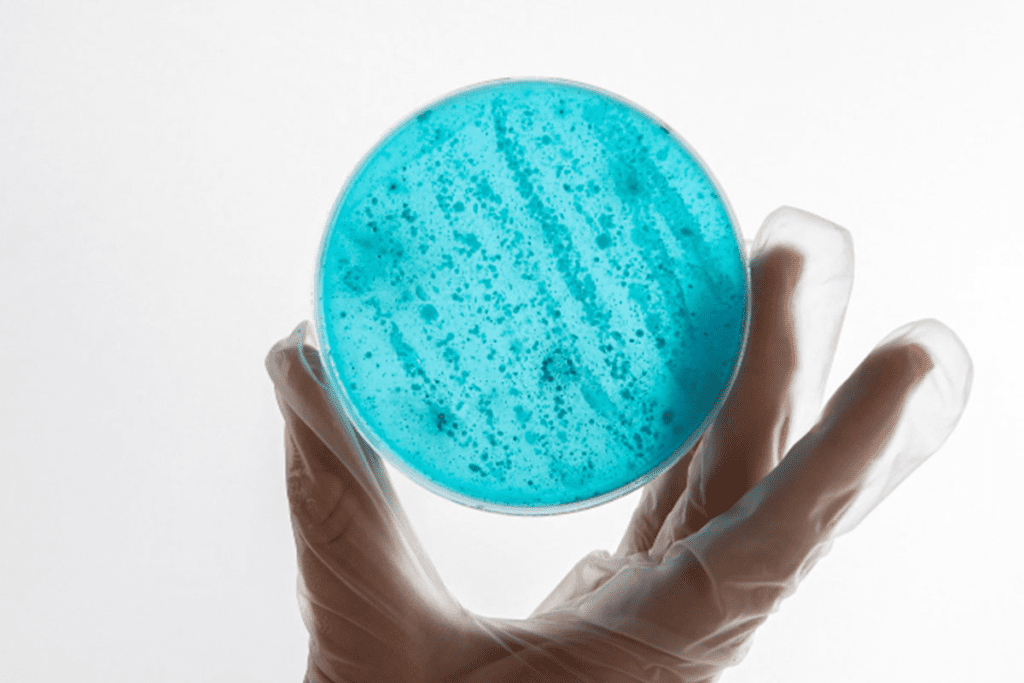 Common Tumor Markers in Cancer Diagnosis: Powerful Indicators