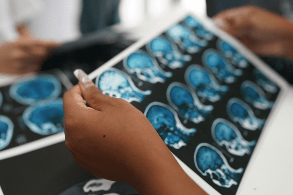 How long does a brain SPECT scan take? 1 brain SPECT scan take