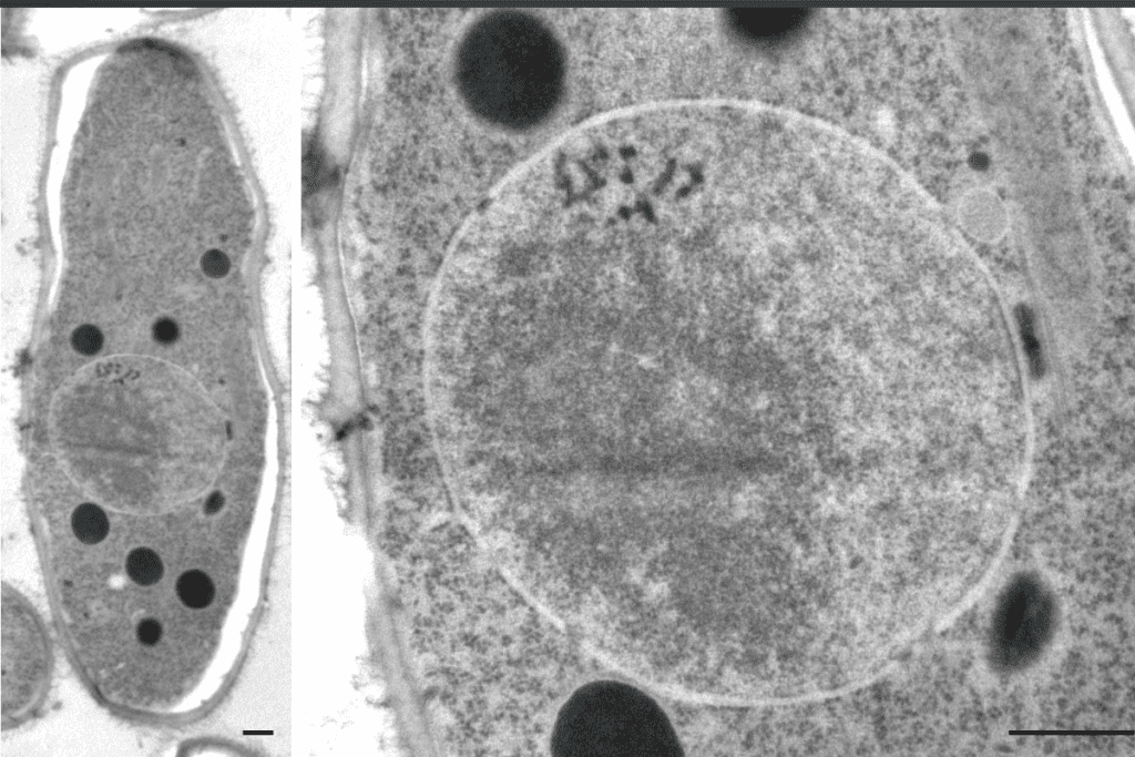 CT Scan Accuracy Cancer: Strengths and Limits in Detecting Tumors