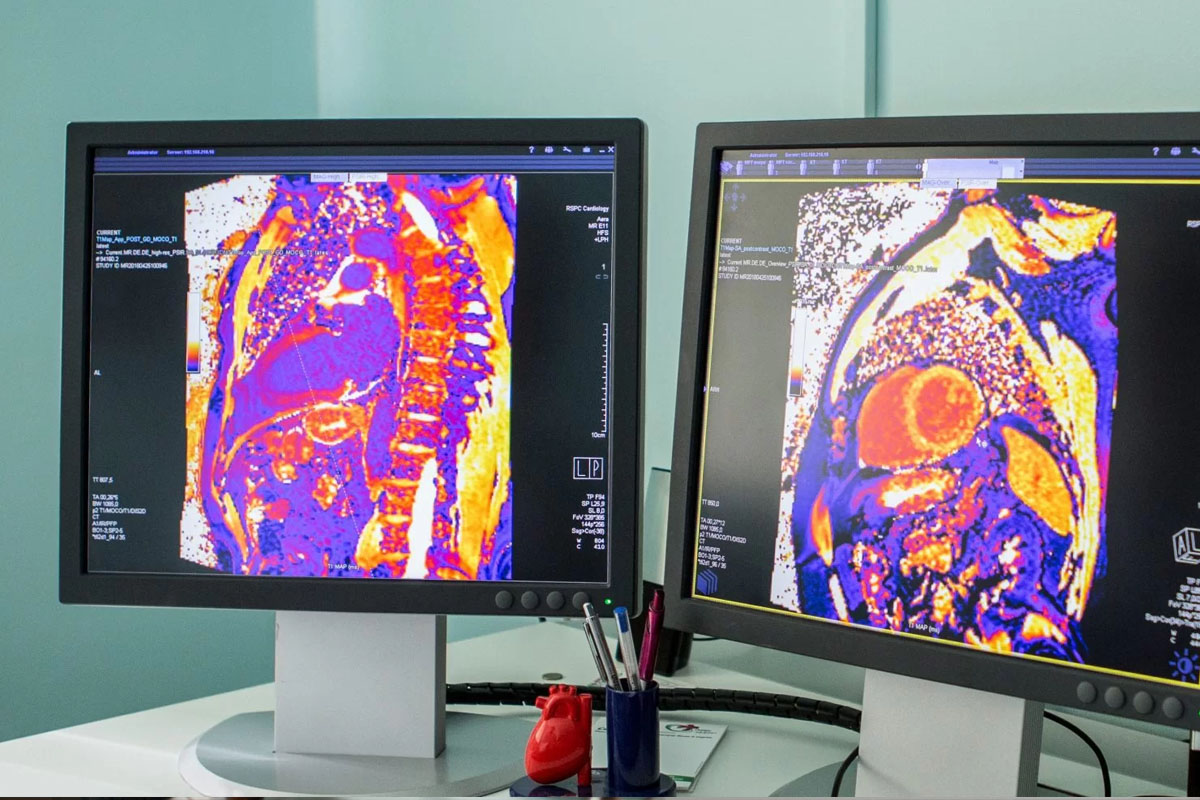 CT Scan Accuracy Cancer: Strengths and Limits in Detecting Tumors