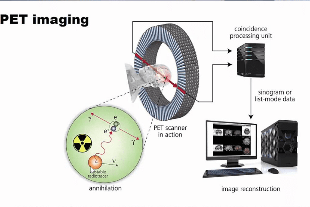 PET Scan Radiation Precautions After Scan: Powerful Safety Tips 2 PET Scan Radiation Precautions After Scan: Powerful Safety Tips