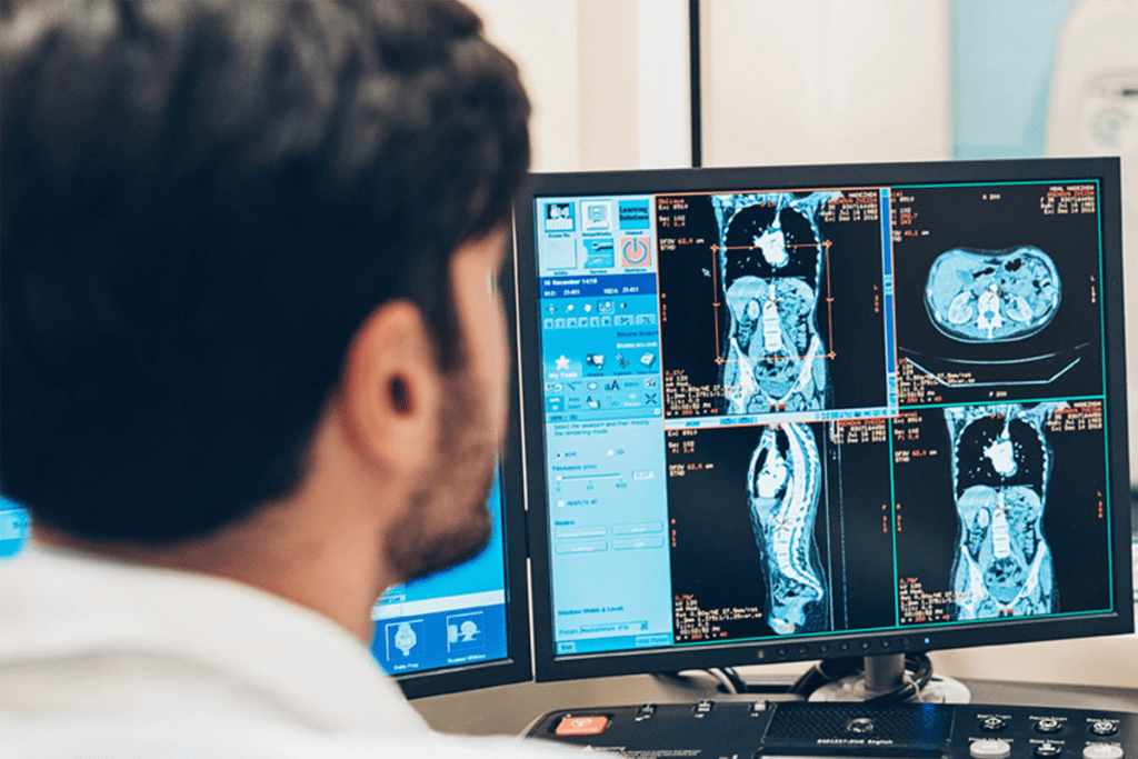 Metabolic Imaging: PET Scans and Their Role in Cancer and Disease Care