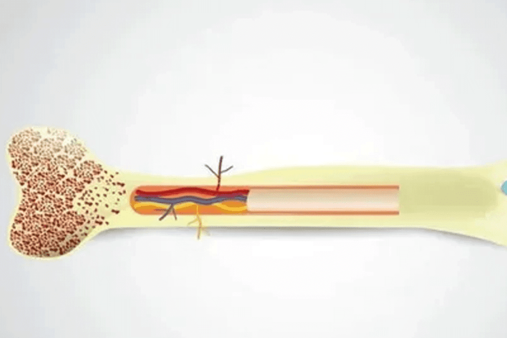  Why Can Only Males Donate Bone Marrow? Understanding How to Donate Bone Marrow