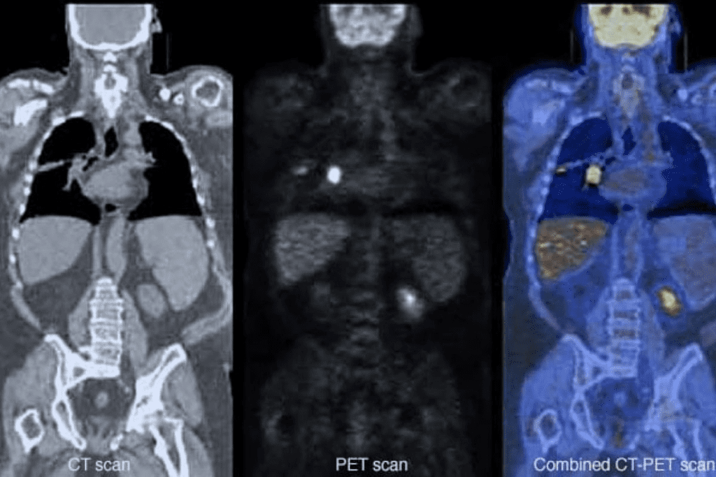 Brush Teeth Before PET Scan: Preparation Tips for Accurate Results