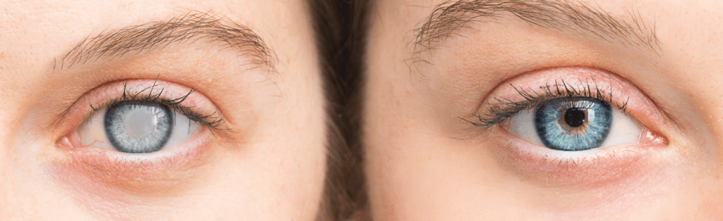 image 891 LIV Hospital