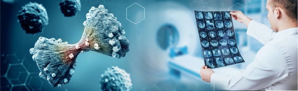 MR Linac 1 image 202 LIV Hospital