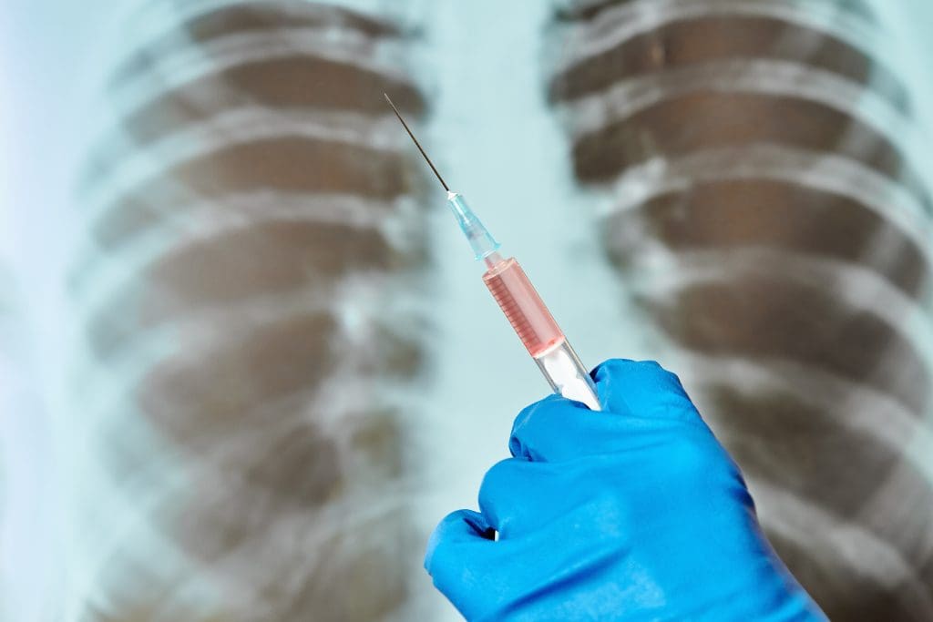 doctor blue medical gloves is holding syringe background lung x ray closeup LIV Hospital