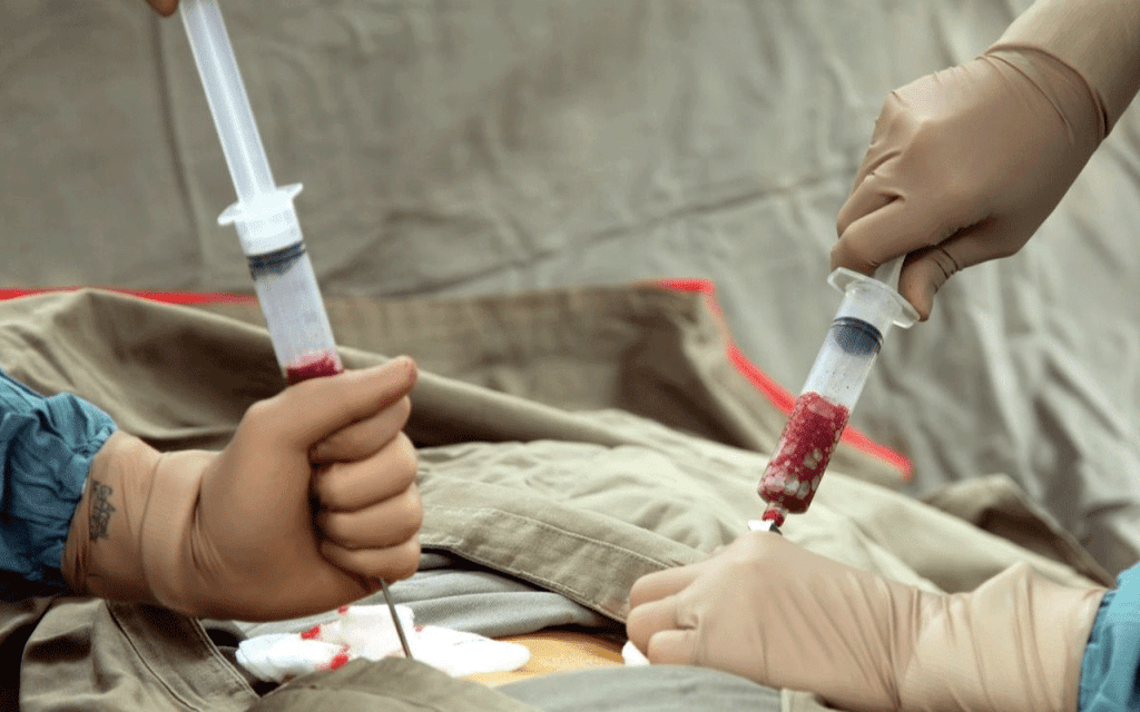 Bone Marrow Transplant Success Rate: Powerful Outcomes and Facts 3 How do you know if a bone marrow transplant is successful?