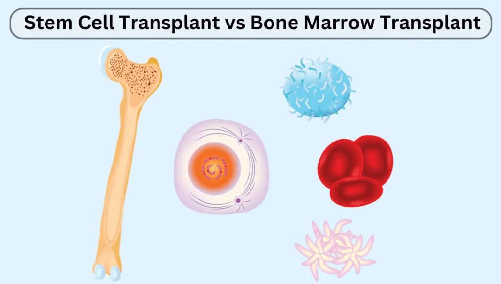 Bone Marrow Transplant Success Rate: Powerful Outcomes and Facts 2 How do you know if a bone marrow transplant is successful?
