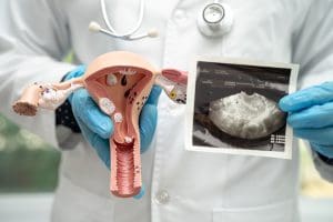 What is Gynecologic Oncology?