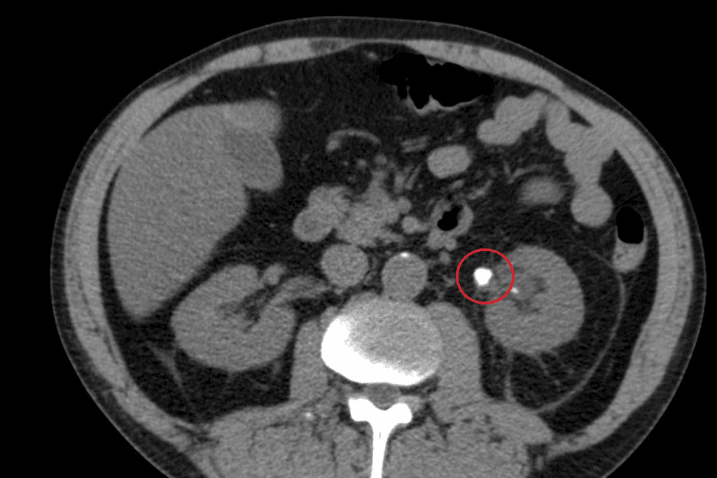 image 829 LIV Hospital