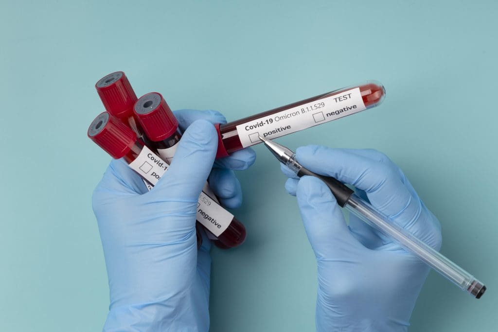 close up blood test omicron LIV Hospital