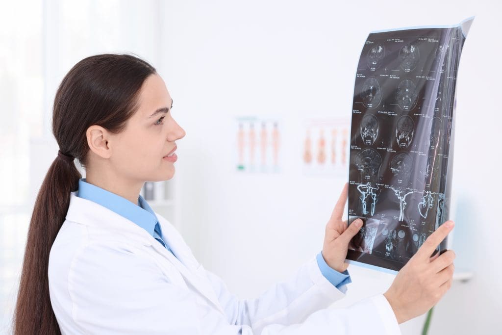 What does a brain SPECT scan diagnose? 1 brain SPECT