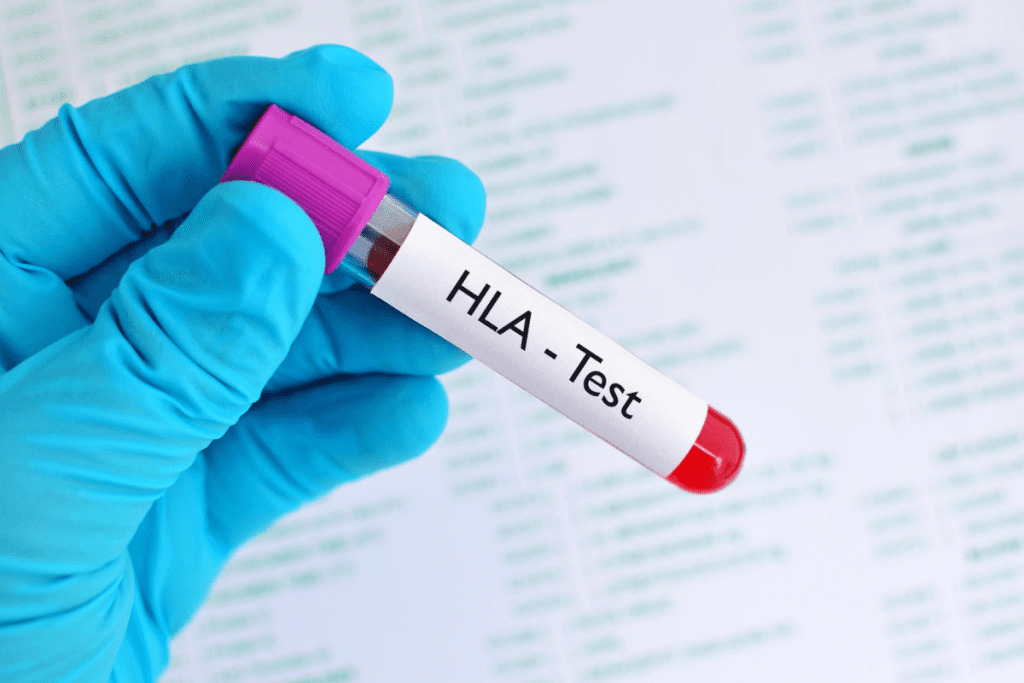 Stem Cell Donation Procedure: What to Expect & Steps Explained 3 Stem Cell Donation Procedure: What to Expect & Steps Explained