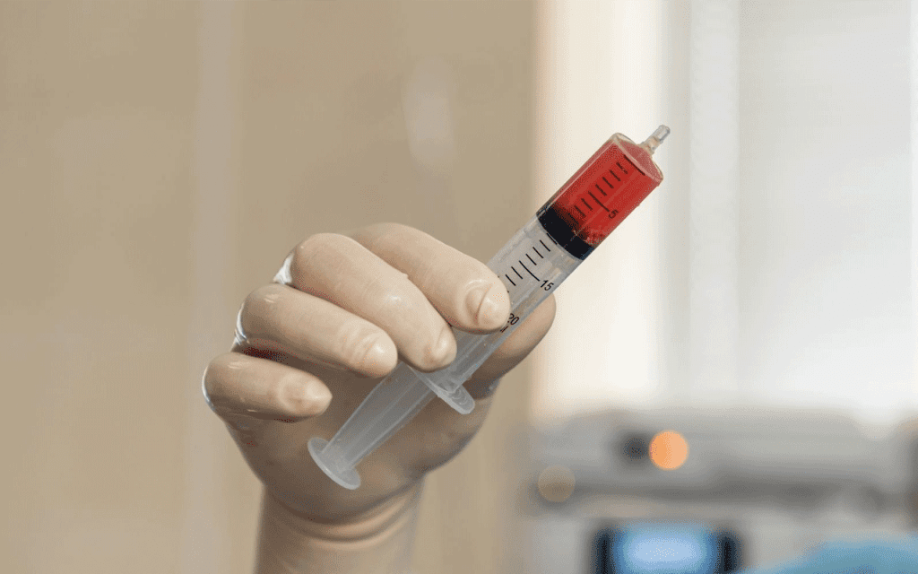 Blood Transplant Side Effects: Powerful Recovery Tips