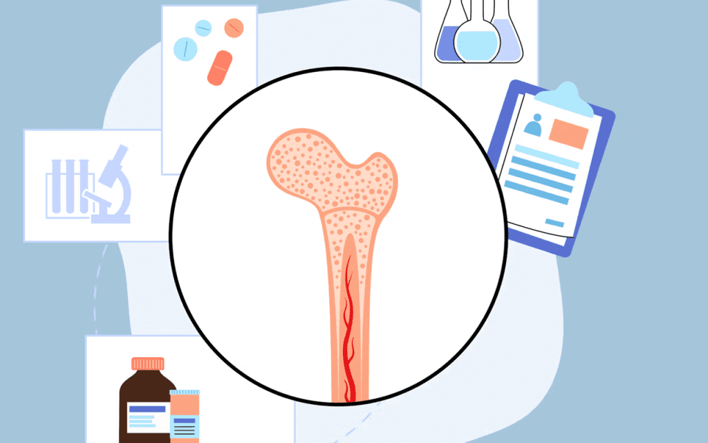 Stem Cell Therapy: An Alternative to Bone Marrow Transplant