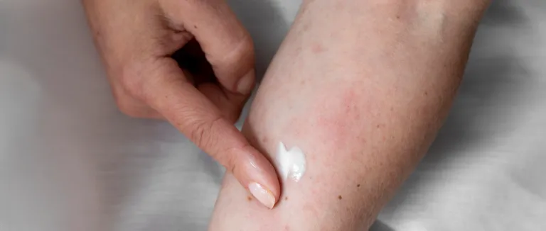 Monkeypox Virus: Essential Facts & Care 2 image 100 LIV Hospital