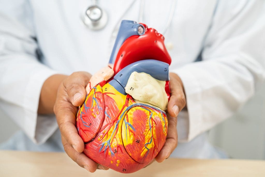 Does a PET scan show clogged arteries