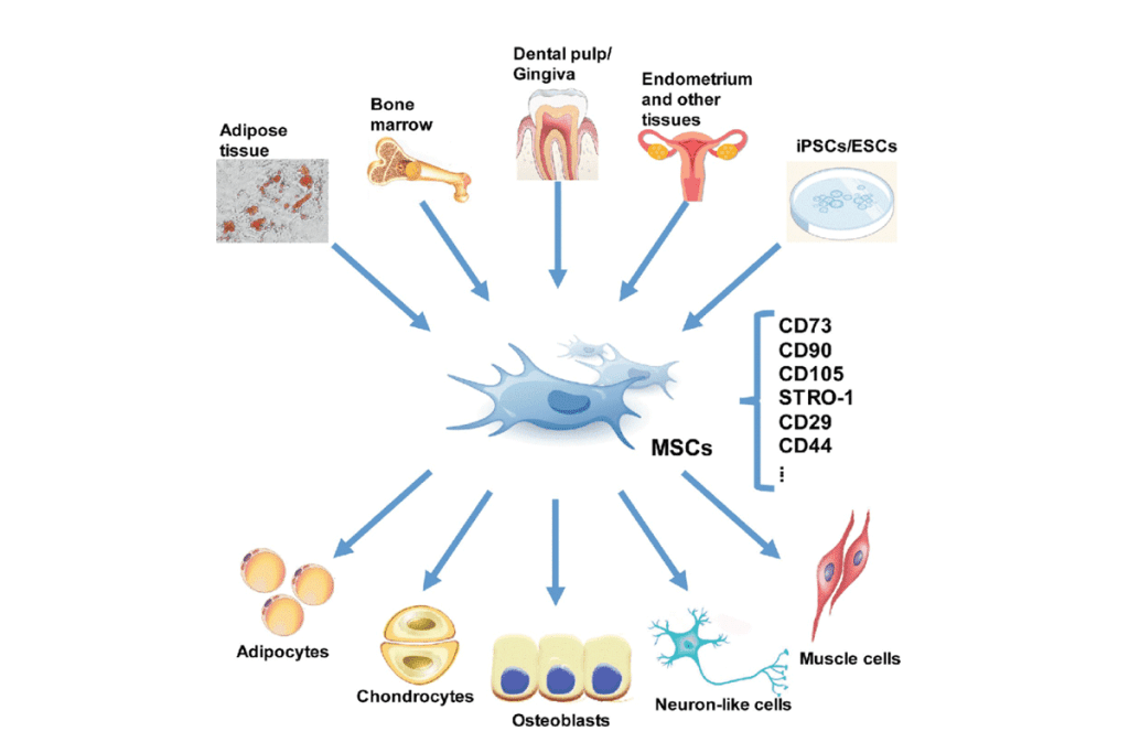 Understanding Mesenchymal Stem Cells Controversy and Stem Cell Therapy Side Effects